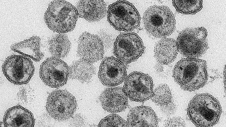 Tarihte aşılar ne kadar sürede geliştirildi?