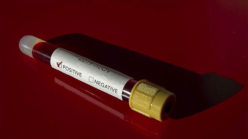 ABD'deki yeni araştırmaya göre D vitamini eksikliği Kovid-19'dan ölüm riskini artırabilir